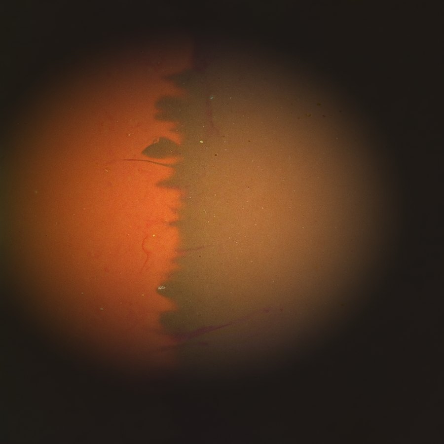 Stamp 01